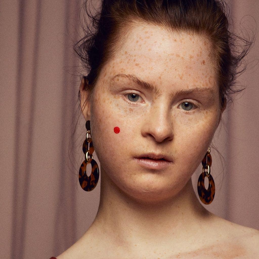 down-syndrome-model